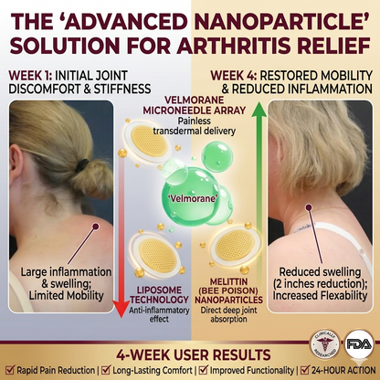【Official Brand Store】Velmorane® – Revolutionary Melittin Nanoparticle Microneedle Patch | 𝟸𝟶𝟸𝟼 𝐵𝑟𝑒𝑎𝑘𝑡ℎ𝑟𝑜𝑢𝑔ℎ 𝑇𝑒𝑐ℎ𝑛𝑜𝑙𝑜𝑔𝑦 𝑓𝑜𝑟 𝑇𝑎𝑟𝑔𝑒𝑡𝑒𝑑 𝐽𝑜𝑖𝑛𝑡 𝑅𝑒𝑙𝑖𝑒𝑓